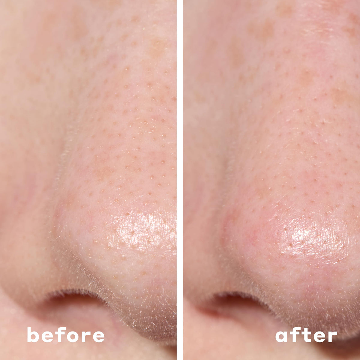 Patch showing built-in silicone bristles for gentle exfoliation