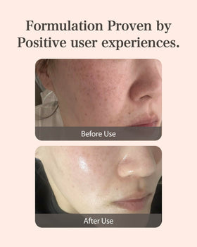 MASTINA Niacinamide 5 percent supports texture and barrier health.