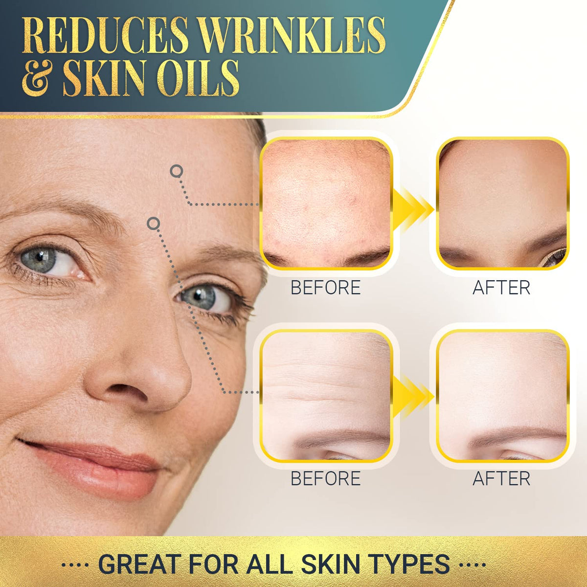 Matykos ingredients graphic with collagen, HA and vitamin A