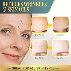 Matykos ingredients graphic with collagen, HA and vitamin A