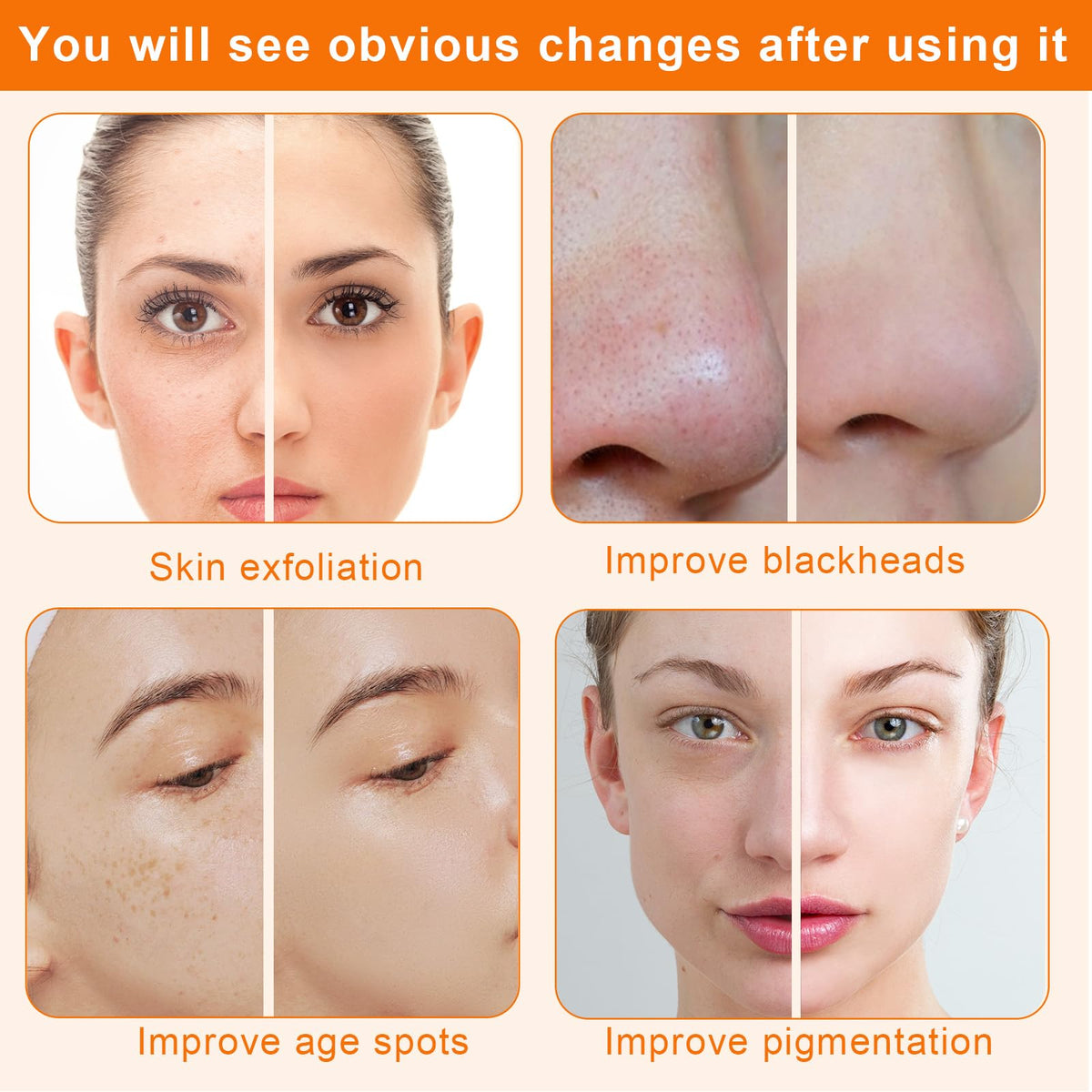 mcwdoit Diamond Microdermabrasion Machine suction detail close-up.