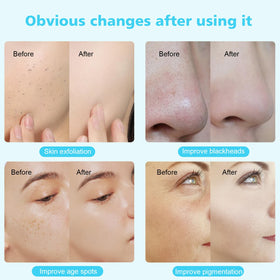mcwdoit home spa skin care kit enables salon quality results