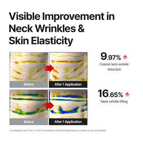 MDP+ Premium Collagen Naite Thread Neck Cream graphic emphasizes Swiss peptides for neck elasticity.