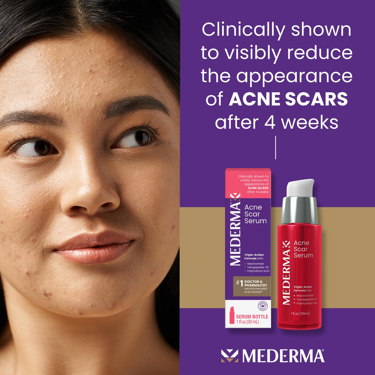 Mederma Serum being applied to skin to smooth acne scars.