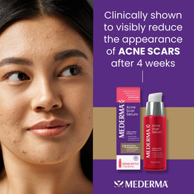 Mederma Serum being applied to skin to smooth acne scars.
