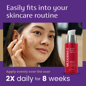 Graphic shows clinical improvement in acne scar appearance after 4 weeks.