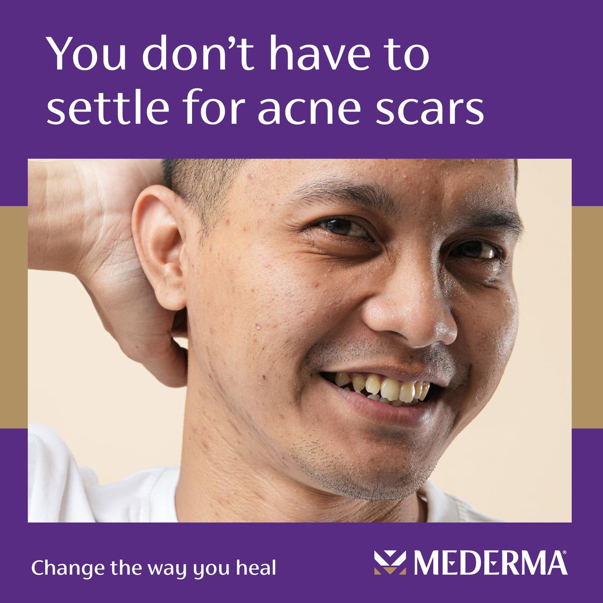 Close-up of hydrated skin after applying Mederma Serum.