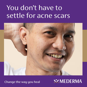 Close-up of hydrated skin after applying Mederma Serum.