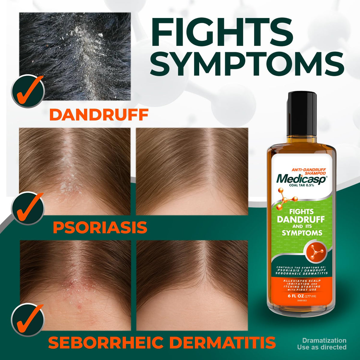 Medicasp anti-dandruff kit displayed for complete scalp care routine.