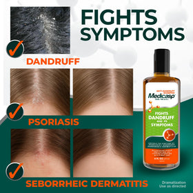 Medicasp anti-dandruff kit displayed for complete scalp care routine.