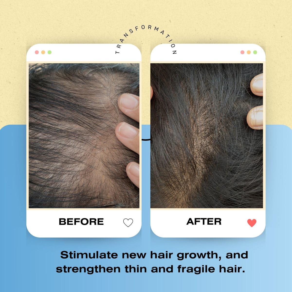 Bioclenz shampoo in use demonstrates simple, daily scalp care