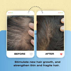 Bioclenz shampoo in use demonstrates simple, daily scalp care