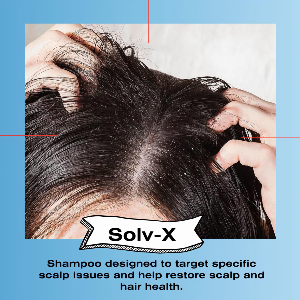 Mediceuticals Solv-X Shampoo packaging on display for daily cleansing of oily hair