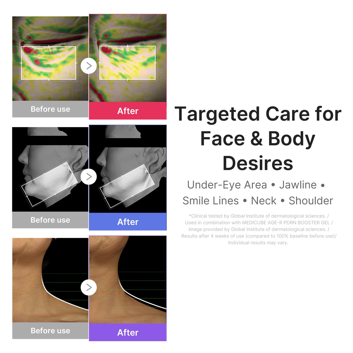 Medicube booster blue mode highlighted for depuffing and definition routines.