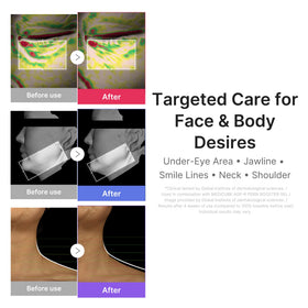 Medicube booster blue mode highlighted for depuffing and definition routines.