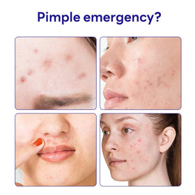 Mediheal Derma Clear patch close-up highlighting hydrocolloid material absorbing exudate.