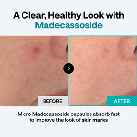 Mediheal Derma Cream Madecassoside jar close-up suggests brightening support.