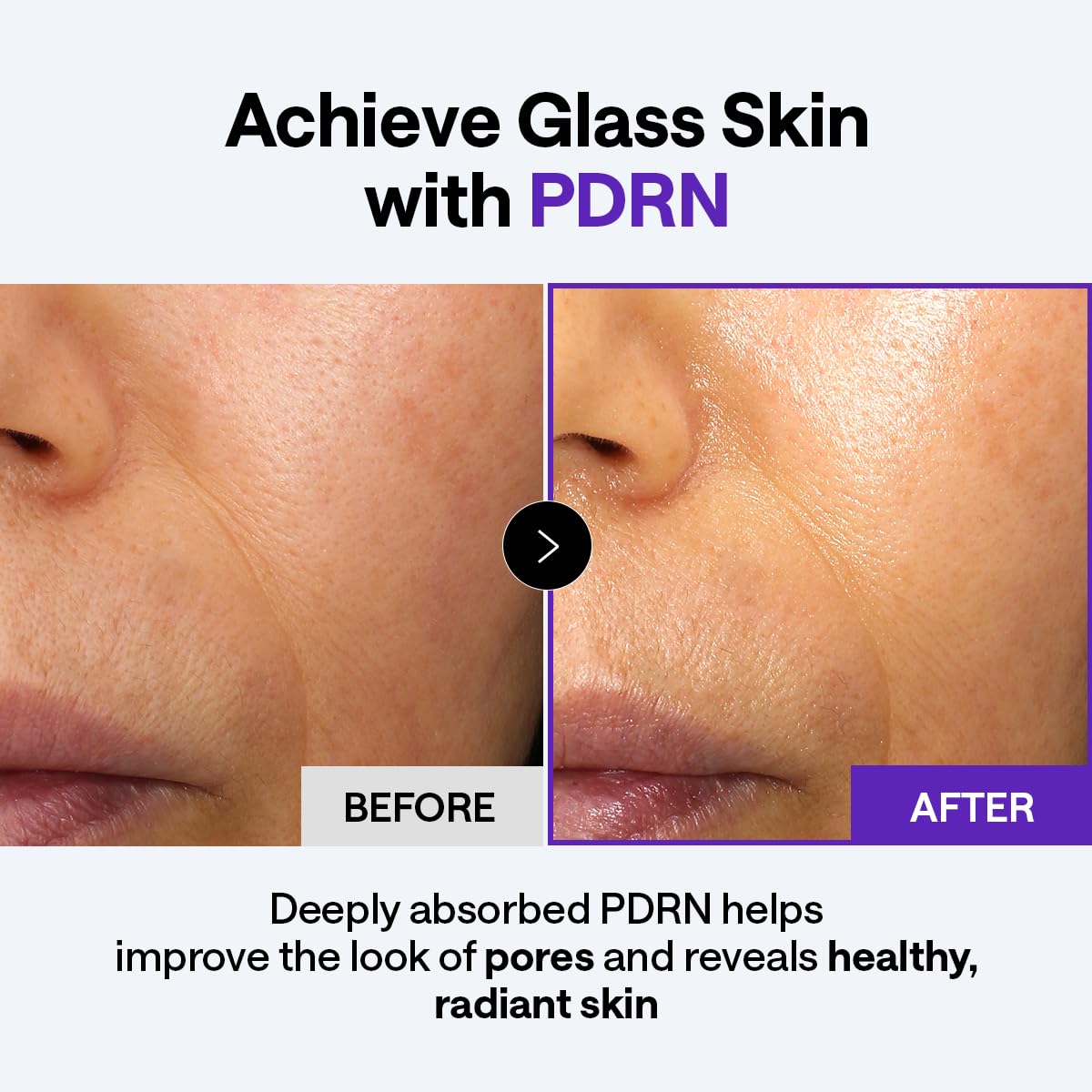 Mediheal Derma Cream PDRN niacinamide-adenosine close-up for even tone and brightness.