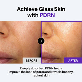 Mediheal Derma Cream PDRN niacinamide-adenosine close-up for even tone and brightness.