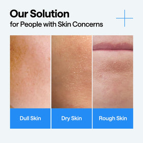 Mediheal Hyaluronate Hydrate Serum on face demonstrates a dewy glow.