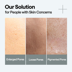 Mediheal Madecassoside close-up of refined pores and balanced complexion.