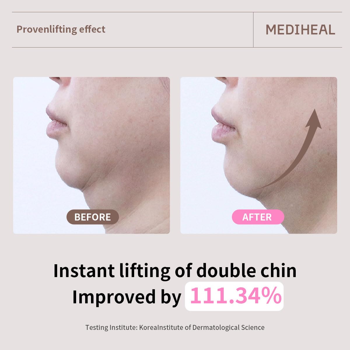 Gentle formula suitable for sensitive skin without worry.