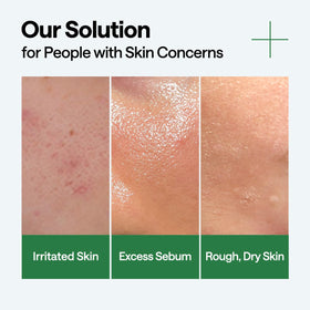 Mediheal Teatree Calming Serum texture sinking into skin for deep moisturization