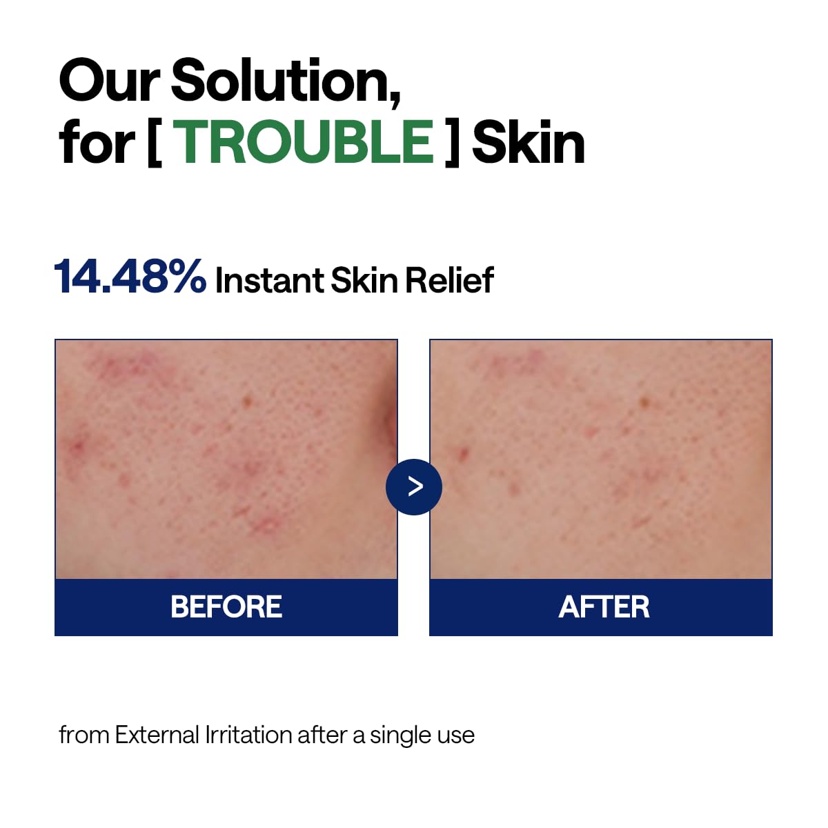 Mediheal Teatree Calming Serum vegan-certified label indicating gentle, ethical care
