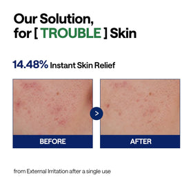 Mediheal Teatree Calming Serum vegan-certified label indicating gentle, ethical care