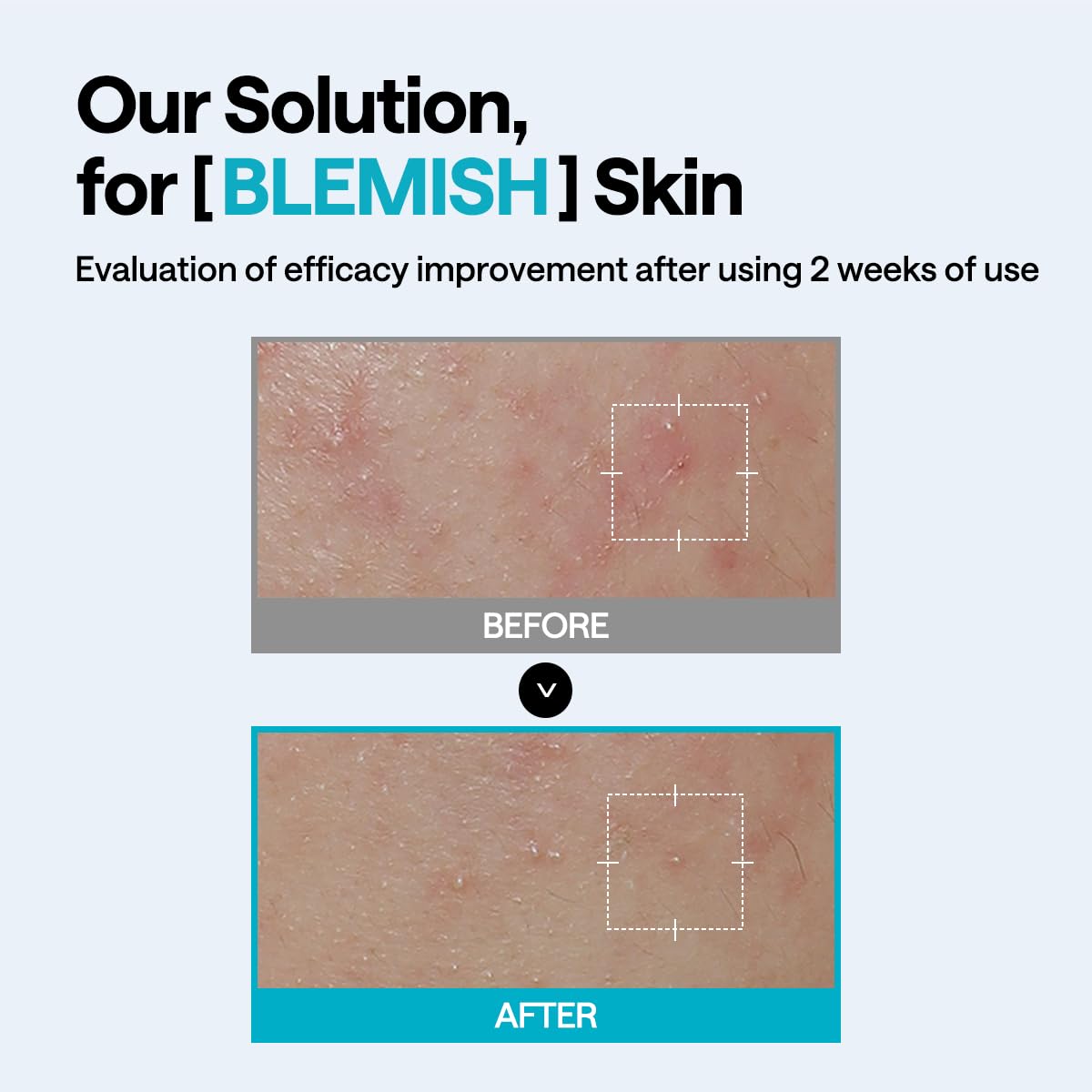 Step-by-step usage illustration: cleanse, tone, apply, remove after 10–20 minutes.