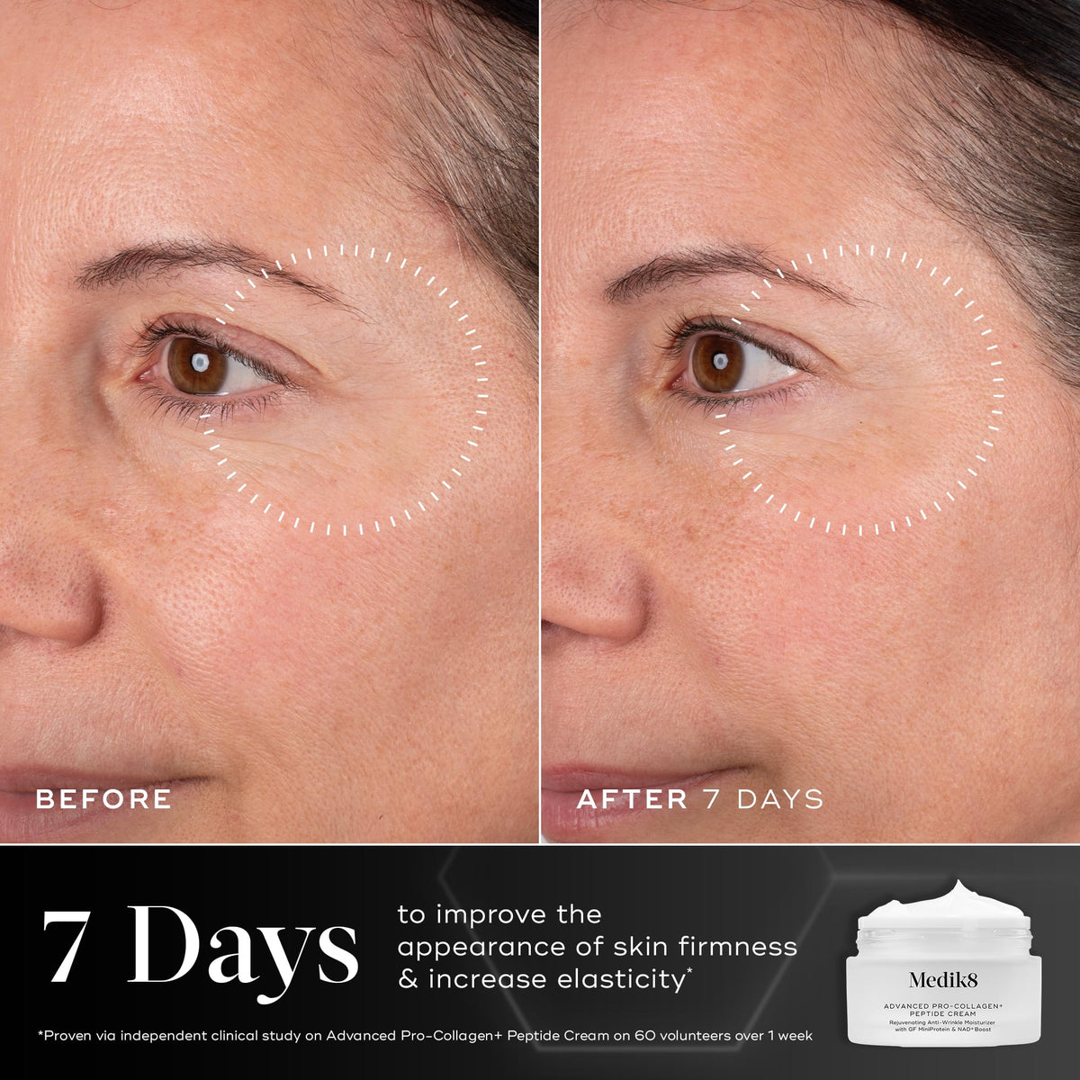 Medik8 Advanced Pro Collagen Peptide Cream cap closeup showing secure seal for freshness