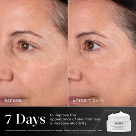 Medik8 Advanced Pro Collagen Peptide Cream cap closeup showing secure seal for freshness