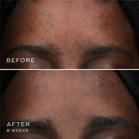 Medik8 Oxy-R Peptides Serum in hand with a soft glow on skin.