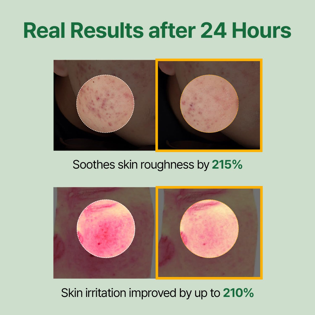 MEDITHERAPY Mugwort Toner application on cotton pads soothes and preps skin