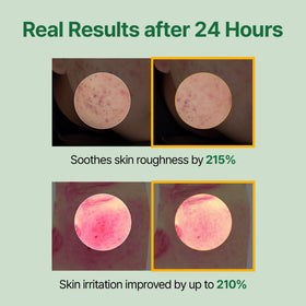 MEDITHERAPY Mugwort Toner application on cotton pads soothes and preps skin