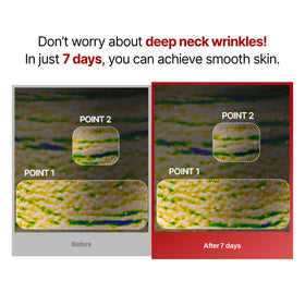 Meditherapy Wrinkle-fit Neck Mask essence for long-lasting hydration