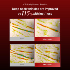 Meditherapy Wrinkle-fit Neck Mask mesh close-up highlights breathable sheet