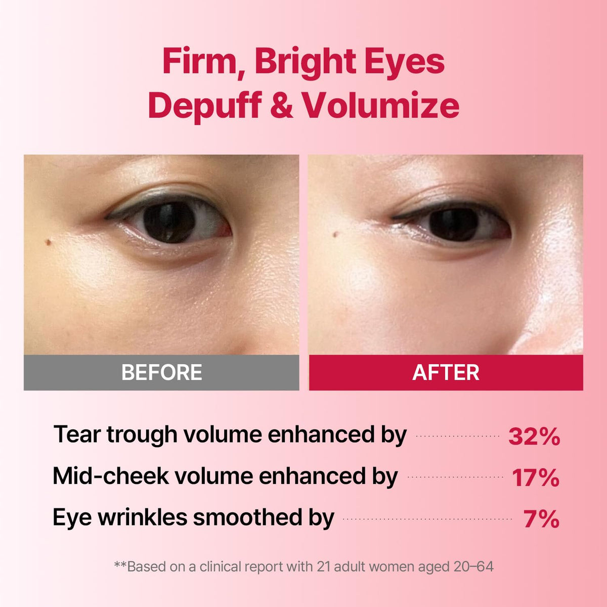 MEDITHERAPY Wrinkle-fit Tangle Eye Patch close-up hydrogel surface delivers refreshing moisture