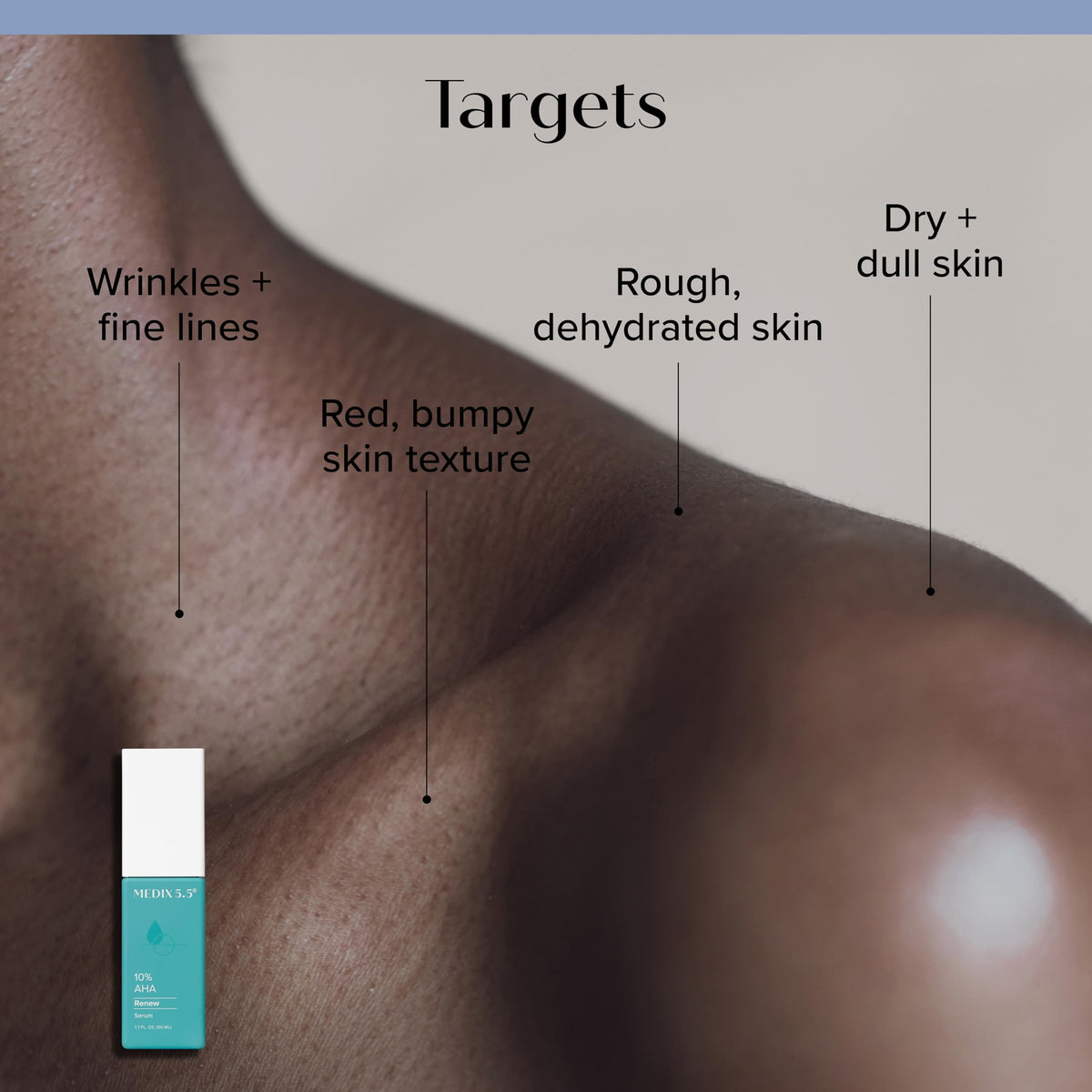 Medix 5.5 exfoliant application image shows leave-on use for smoother skin