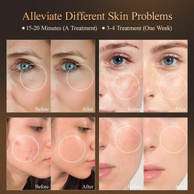 MEGELIN eye pads design showing eye safety during treatments