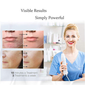 Meifuly high-frequency wand colorful tubes side view for adjustable options.