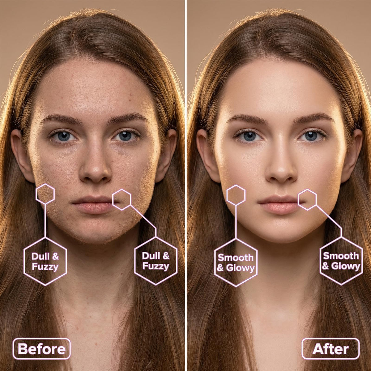 MEKEET Sonic Dermaplaning Tool removes peach fuzz on the cheek area