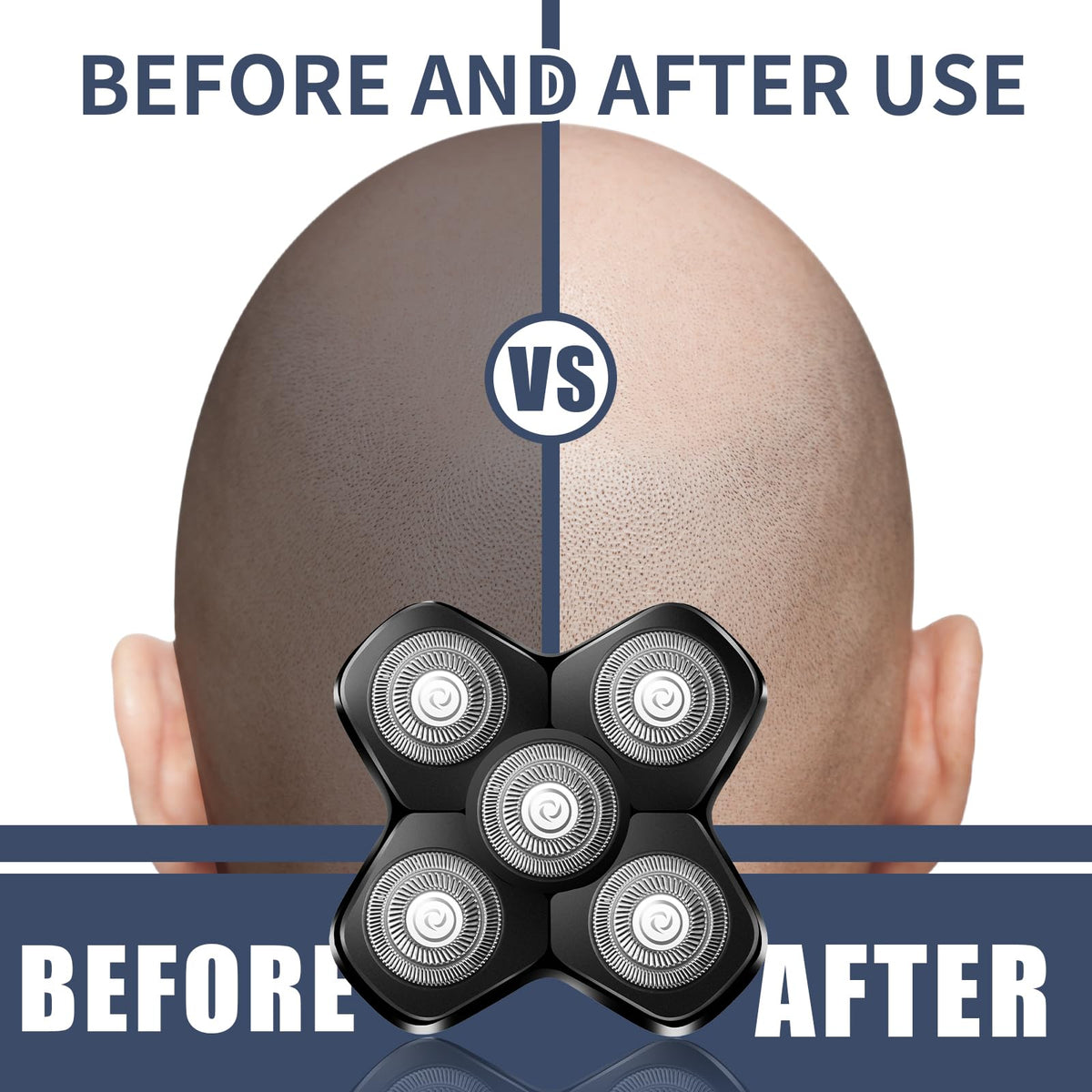 MEMIRY ultra-thin foils enable a 10mm close shave for a bald look.
