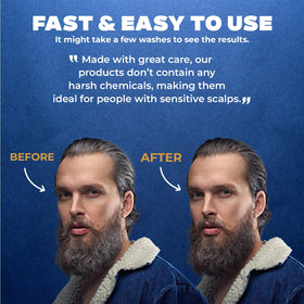 MENFIRST Gray Reducing Shampoo before-after illustrates gradual results.