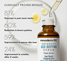 Mesoderm RX brightening serum tackles dark spots for even tone