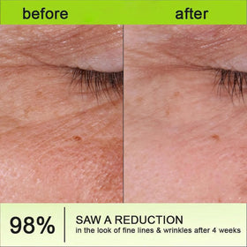 Mfxalx Botoxmix Vita-A Retinol Cream packaging box and branding