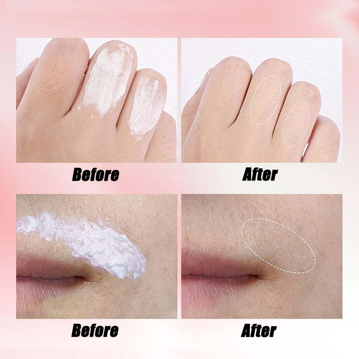 Applying Joy Cream to skin for fast 5-minute hair removal