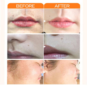 Final look after Joy Facial Hair Remover for lasting smoothness