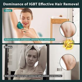 Mihilo IPL three mode control for face, body, and bikini