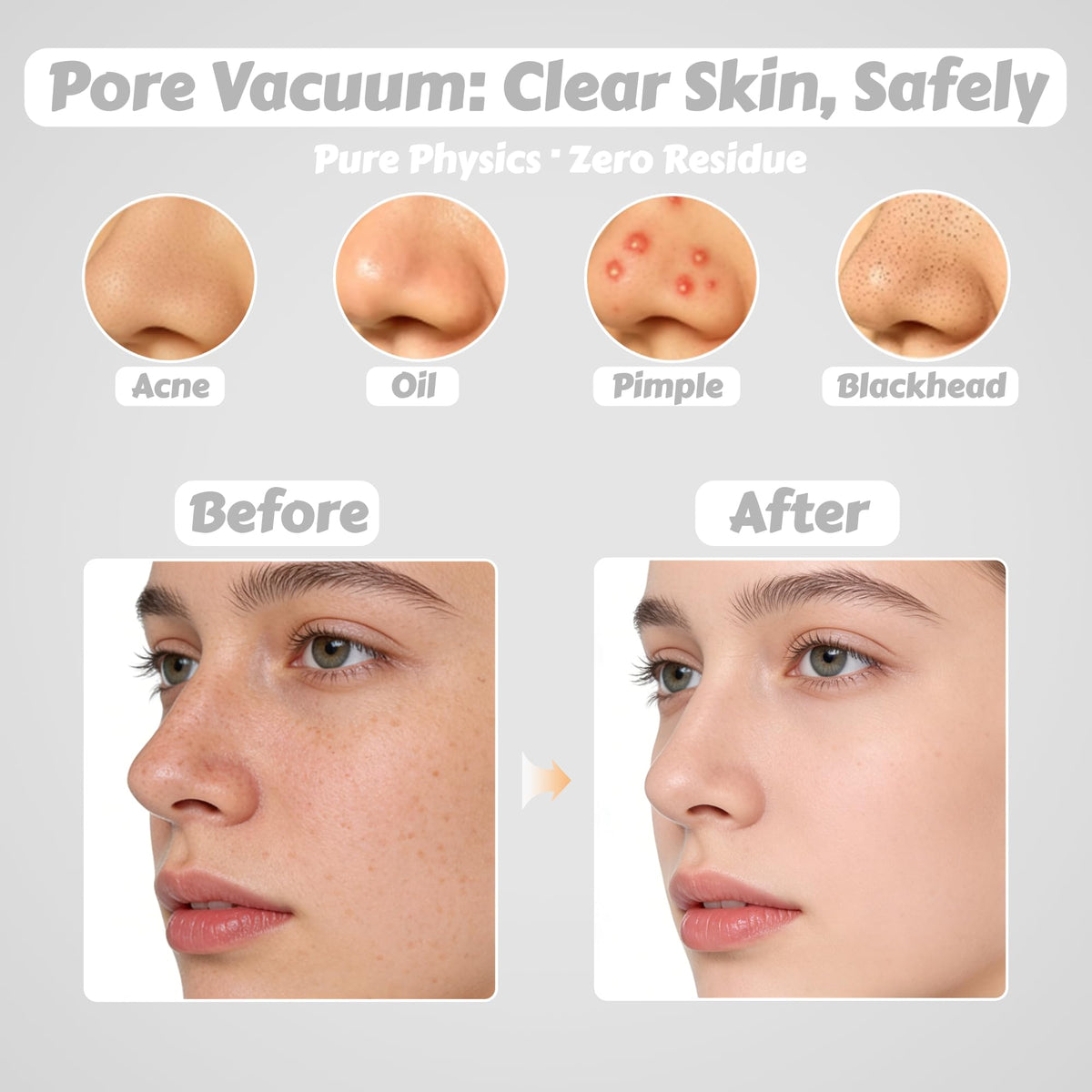 Miley Pore Vacuum showing three suction levels for customizable care